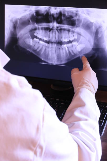 Best Knocked-Out Tooth (Avulsed Tooth) Treatment in Carrier Mls, IL