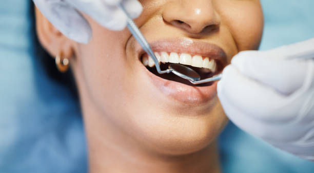 Best Broken or Chipped Tooth Repair in Carrier Mls, IL